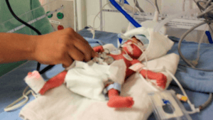 Denuncian posible muerte de siete bebés por bacteria en Hospital Militar